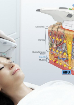 Hifu là gì? Hifu có an toàn không? Giải đáp những băn khoăn của bạn