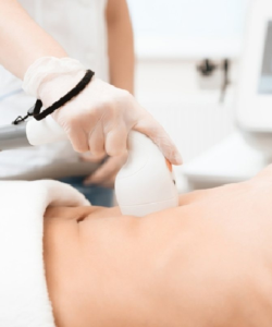 Triệt lông bụng