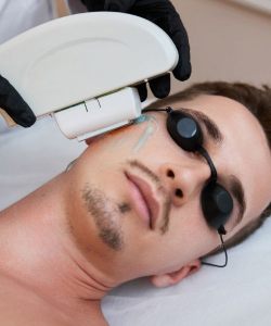 Triệt râu quai nón